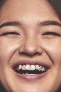 malocclusion patient